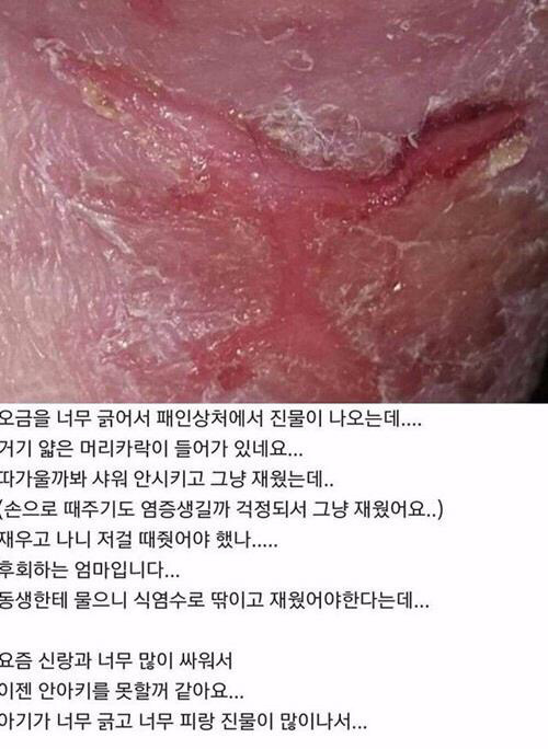 혐주의/ 안아키가 뭔지 아직 모르는 사람들 다 들어와봐.. 이거 생각보다 심각한 사회문제임 | 인스티즈