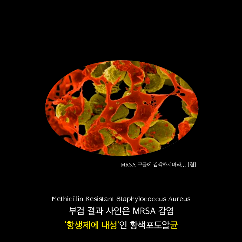 항생제의 역습 | 인스티즈