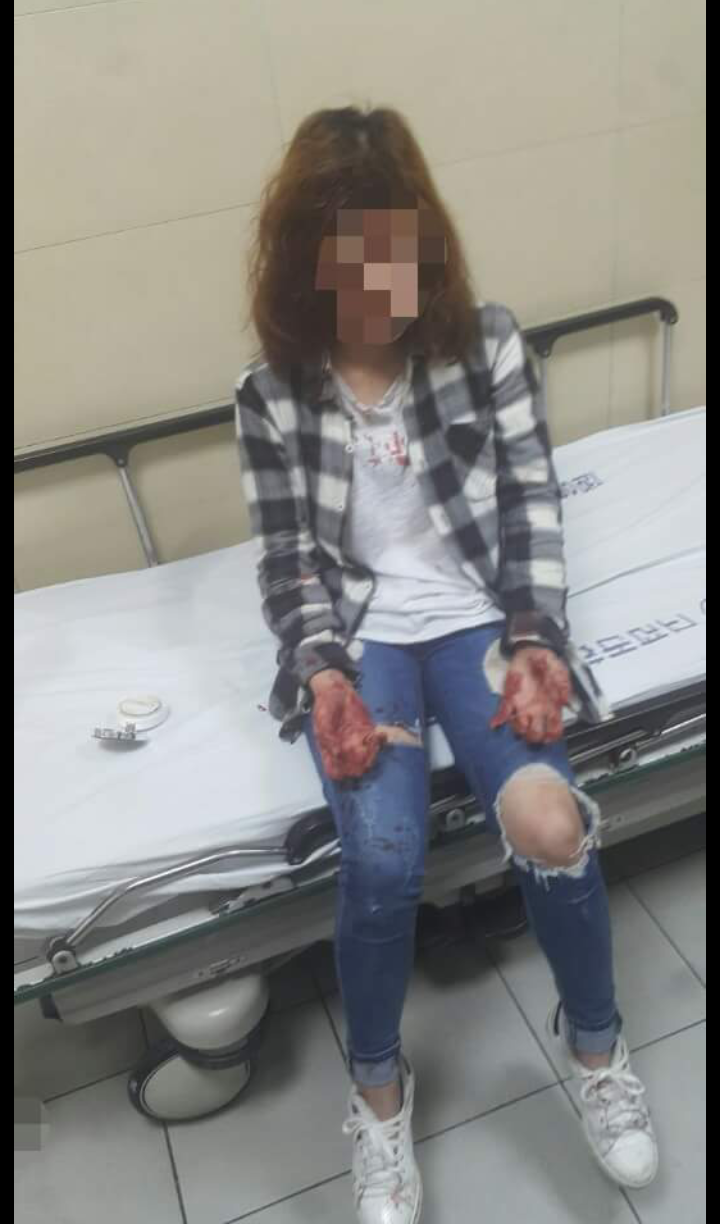 전남친 이랑 말 몇마디했다고 여친 폭행한 미(피흘리는 사진있음) | 인스티즈