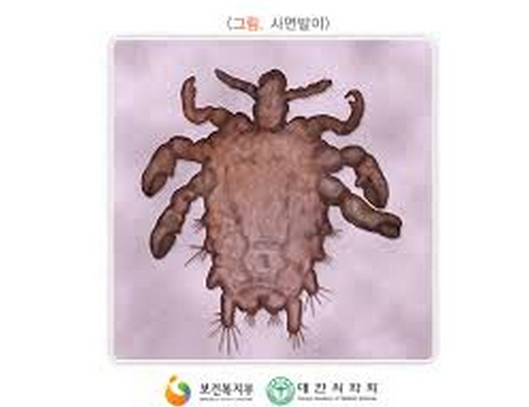 군대에서 한 두명정도 걸리는 질병 (혐오주의) | 인스티즈