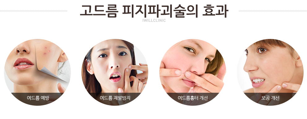 아이윌 이미지