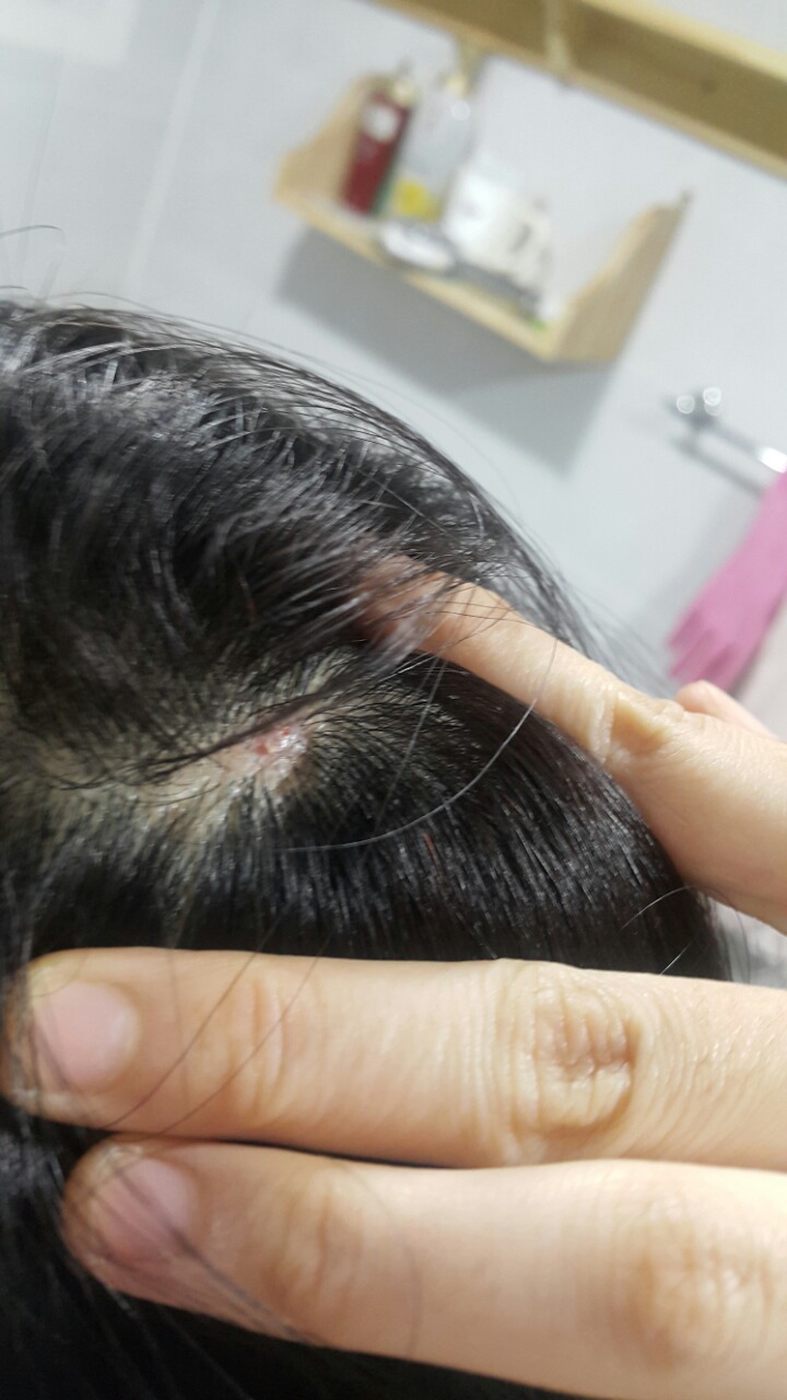 나는 데이트폭력을 당한 피해자였다.10번을 신고했고 10번다 나는 벗어나지 못했다. 죽기싫어서 계속 맞아야 했다.6 | 인스티즈