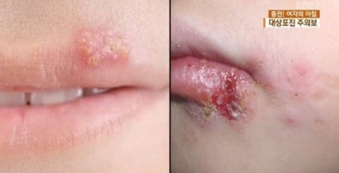 안고가야하는 내 삶의 질을 떨어뜨리는 잔병치레 모음 | 인스티즈