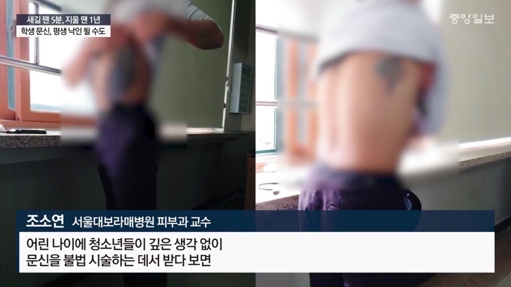 문신하고 후회하는 10대들 | 인스티즈