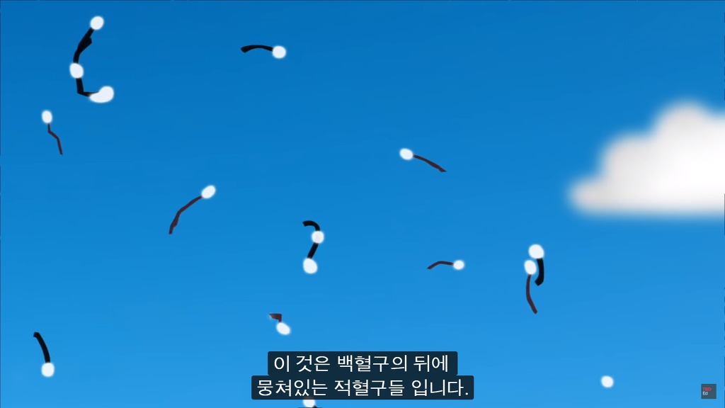 여러분의 눈에 둥둥 떠다니는 그것들은 무엇일까요? | 인스티즈