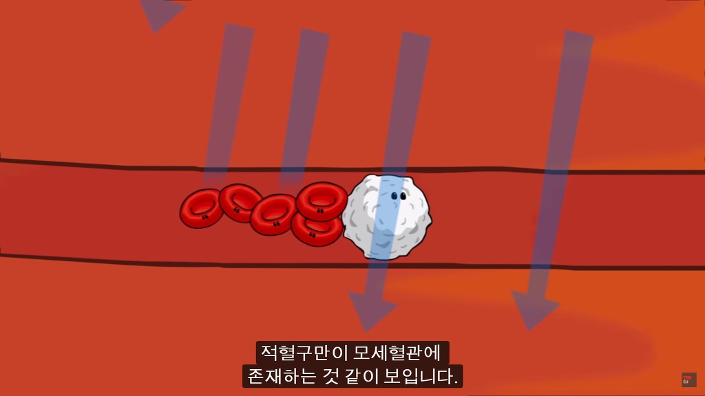 여러분의 눈에 둥둥 떠다니는 그것들은 무엇일까요? | 인스티즈
